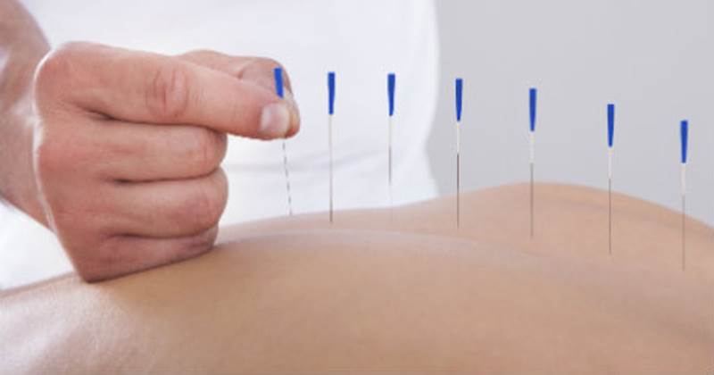 Aarhus Rygklinik tilbyder professionel akupunktur som kan smertelindre og afspænde muskler